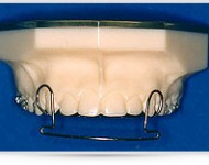 Visione frontale arco III cl